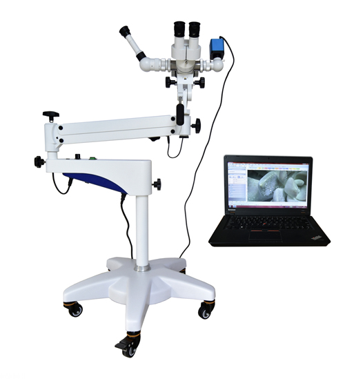Hot Sale&nbsp;Optical Colposcope
