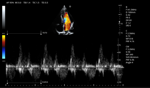 Portable Color Doppler Ultrasound-0