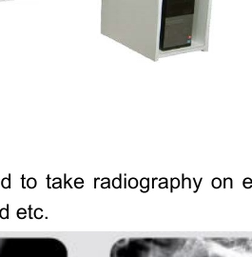 Cervical Spine X-ray
